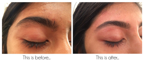 Brow Shaping